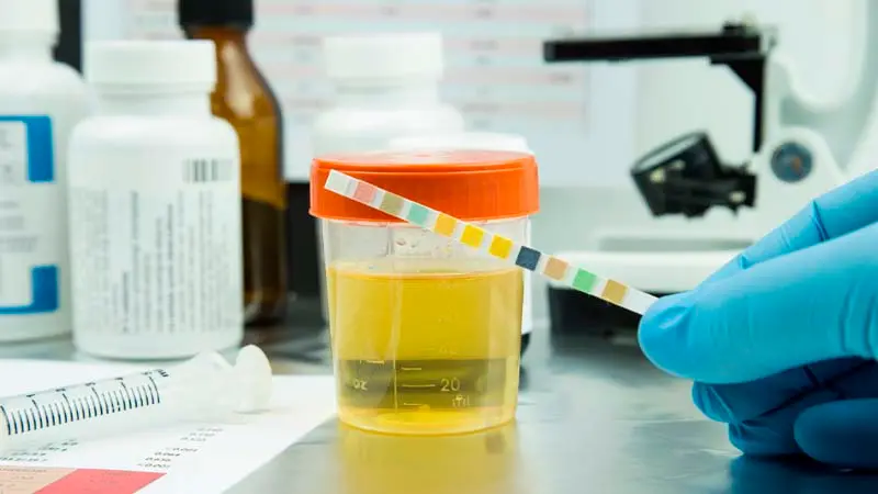 El test de orina es una de las pruebas más eficaces para diagnosticar la diabetes insípida